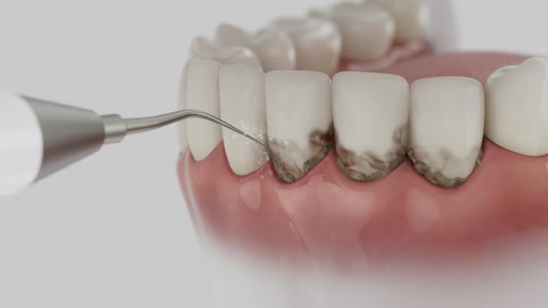 Reliable Dental Implants contractor in Harmony, RI by Smile Center Dentistry